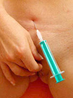 Injections into belly and labia